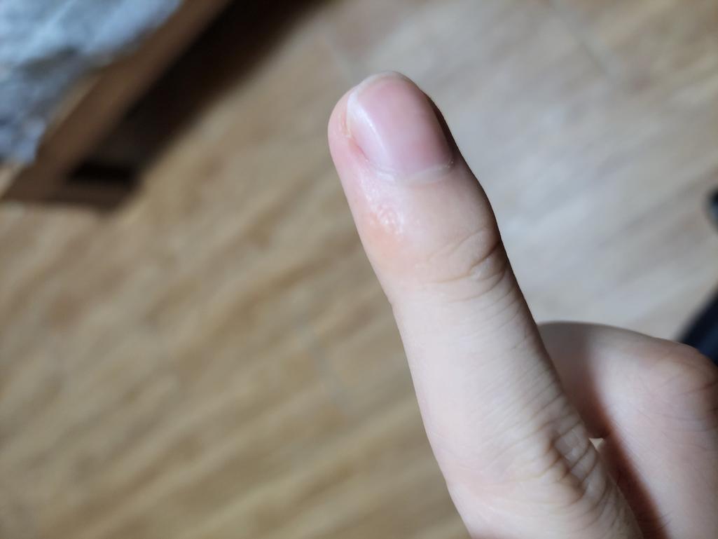 2번 째 사진