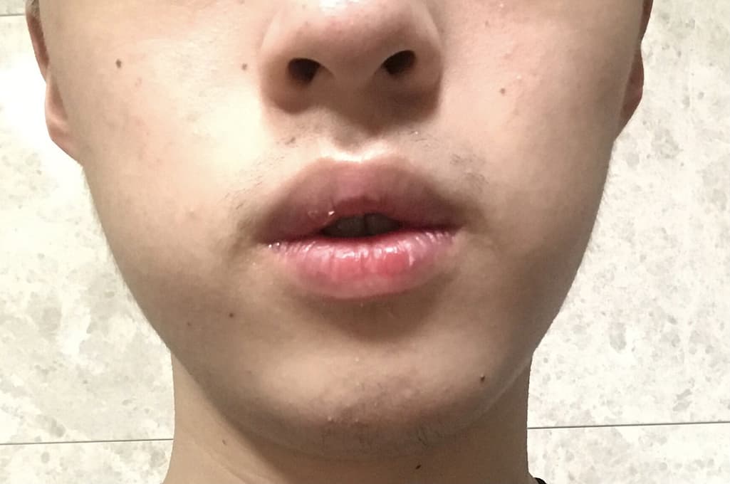 1번 째 사진