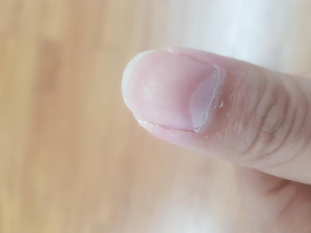 3번 째 사진