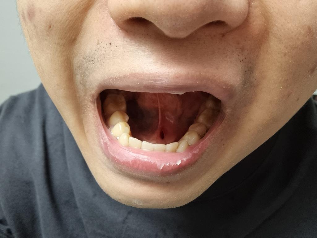 1번 째 사진