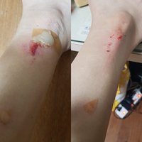 1번 째 사진