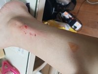 2번 째 사진