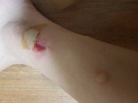 4번 째 사진