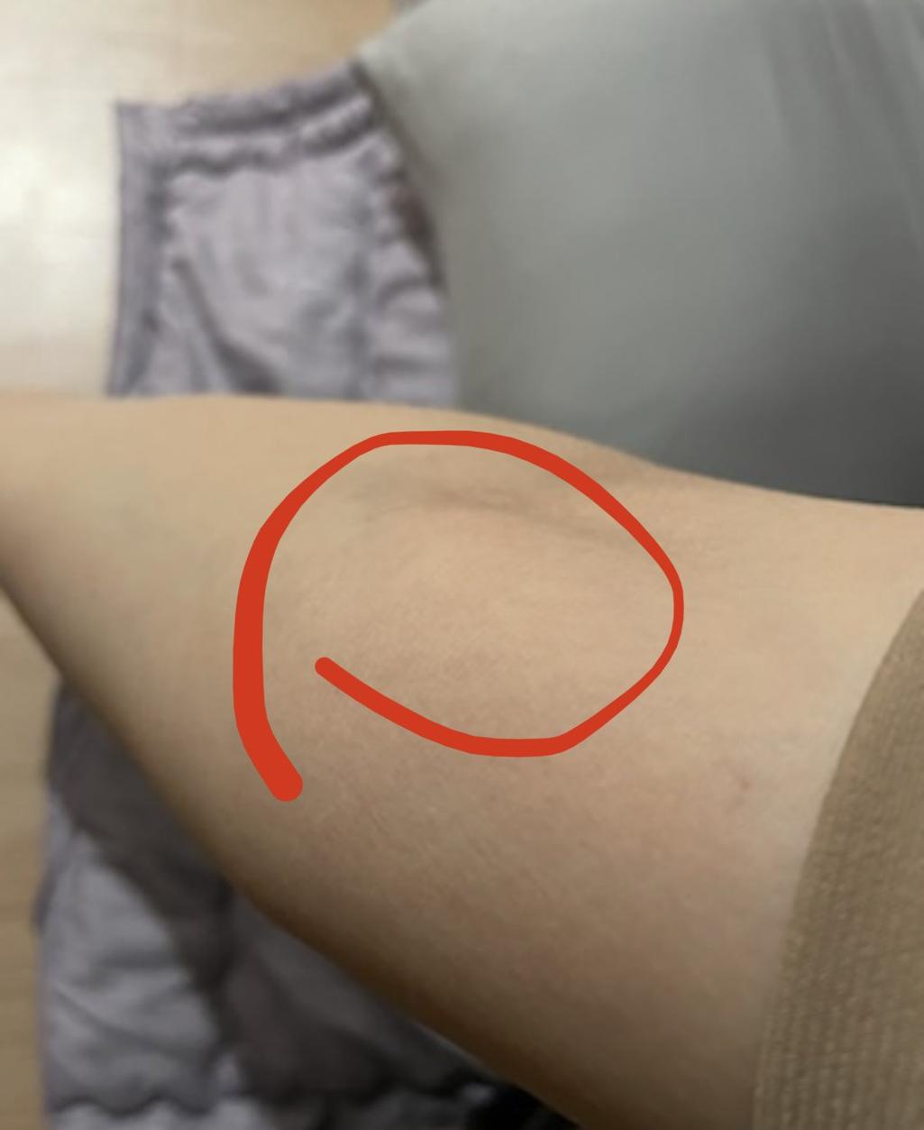 2번 째 사진