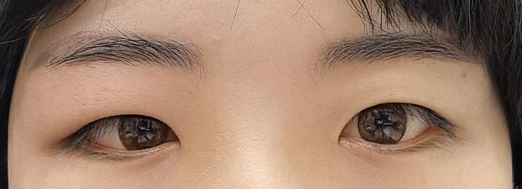 2번 째 사진