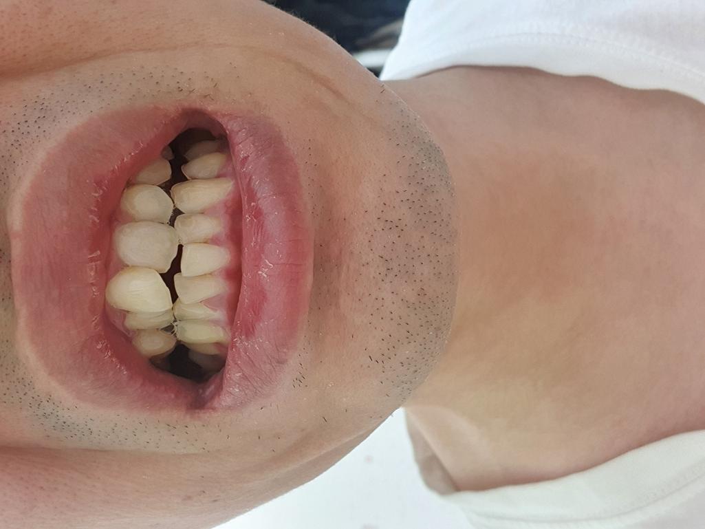 1번 째 사진