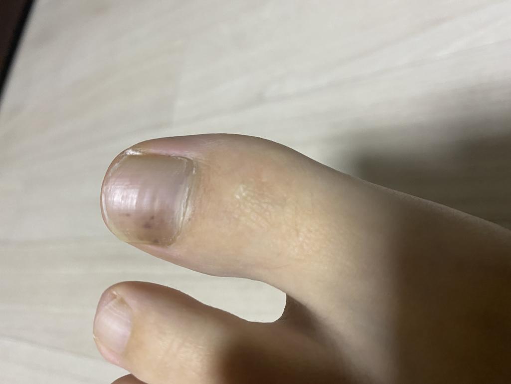 3번 째 사진