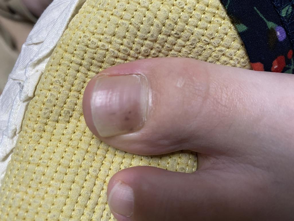 2번 째 사진