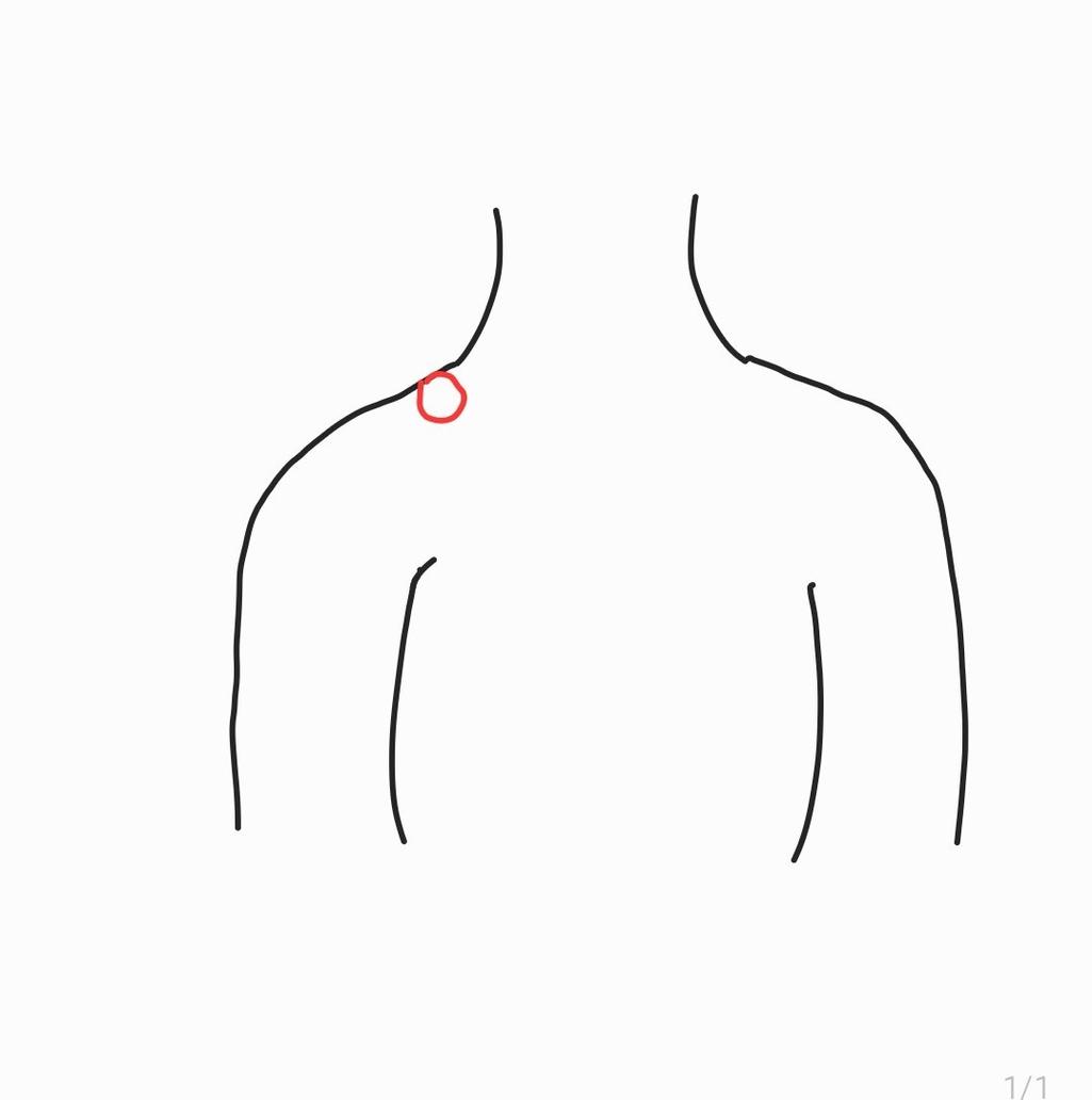 2번 째 사진
