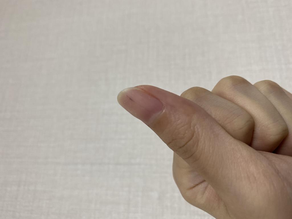 2번 째 사진