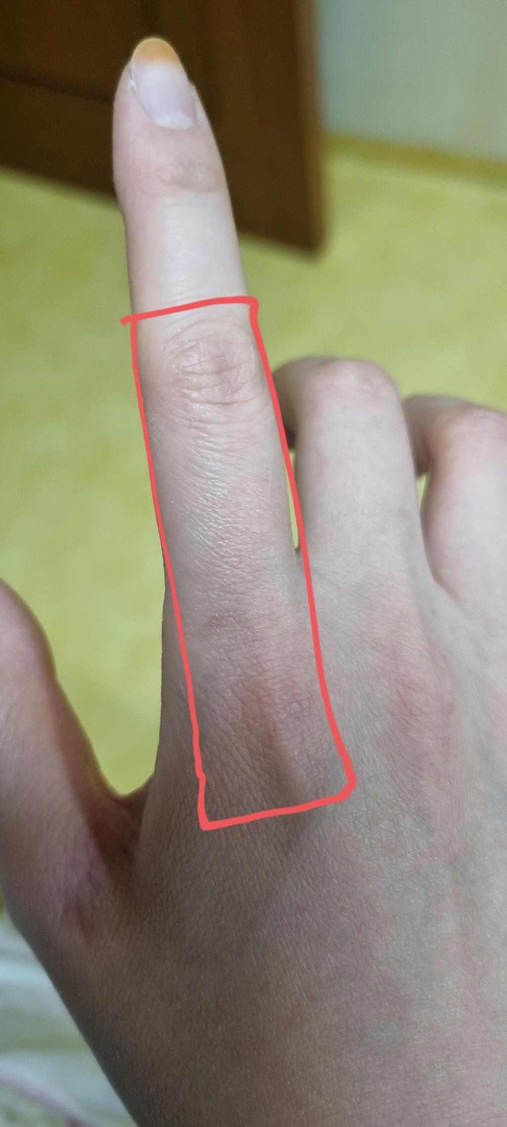2번 째 사진
