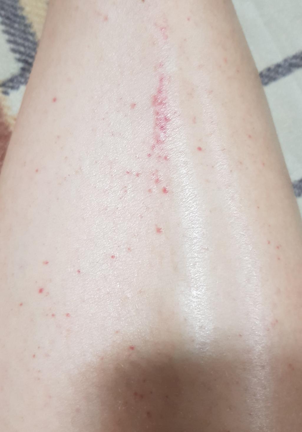 2번 째 사진