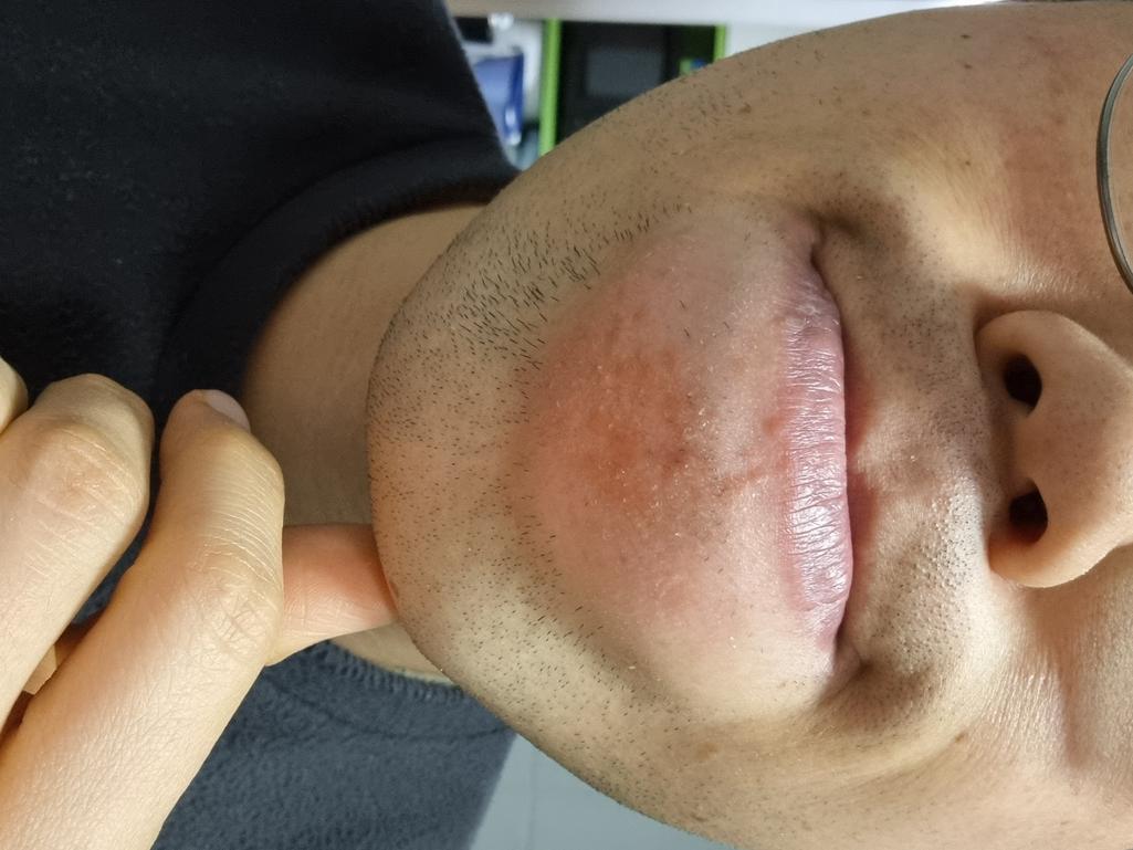 1번 째 사진