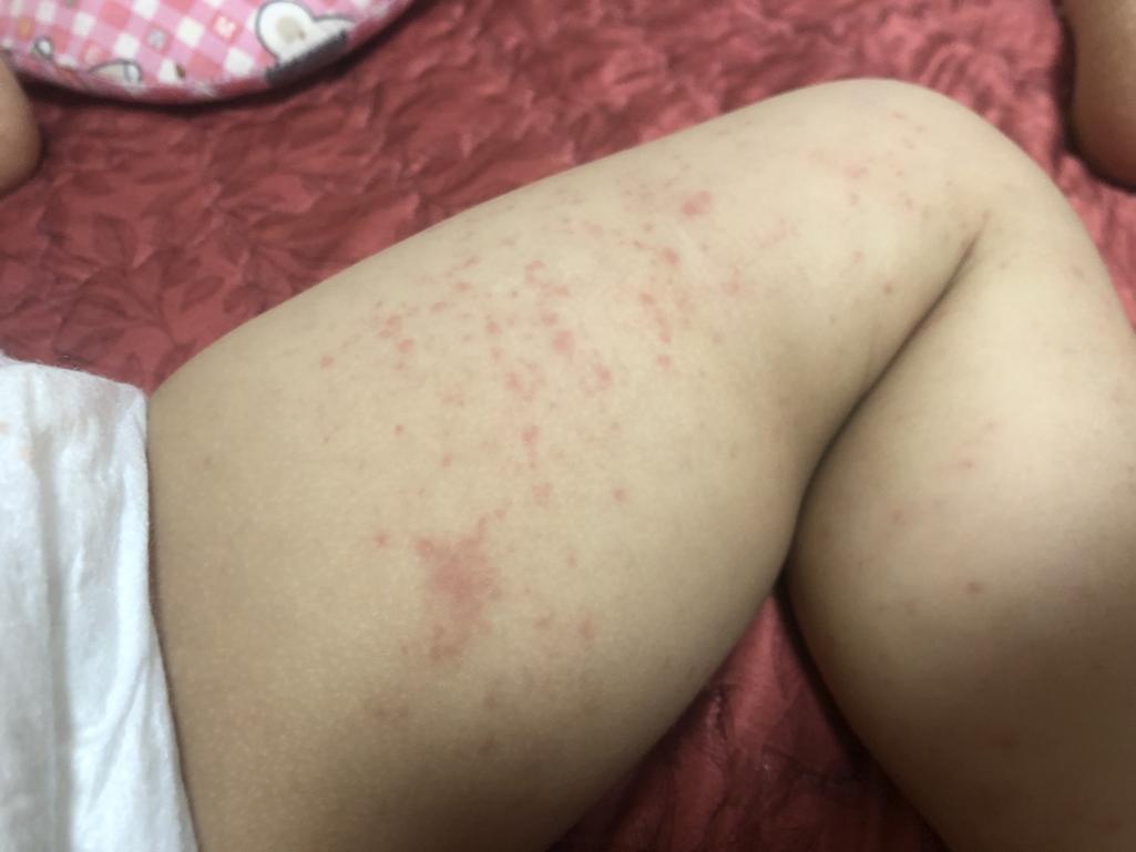 2번 째 사진
