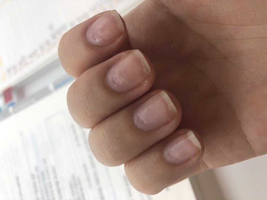 2번 째 사진