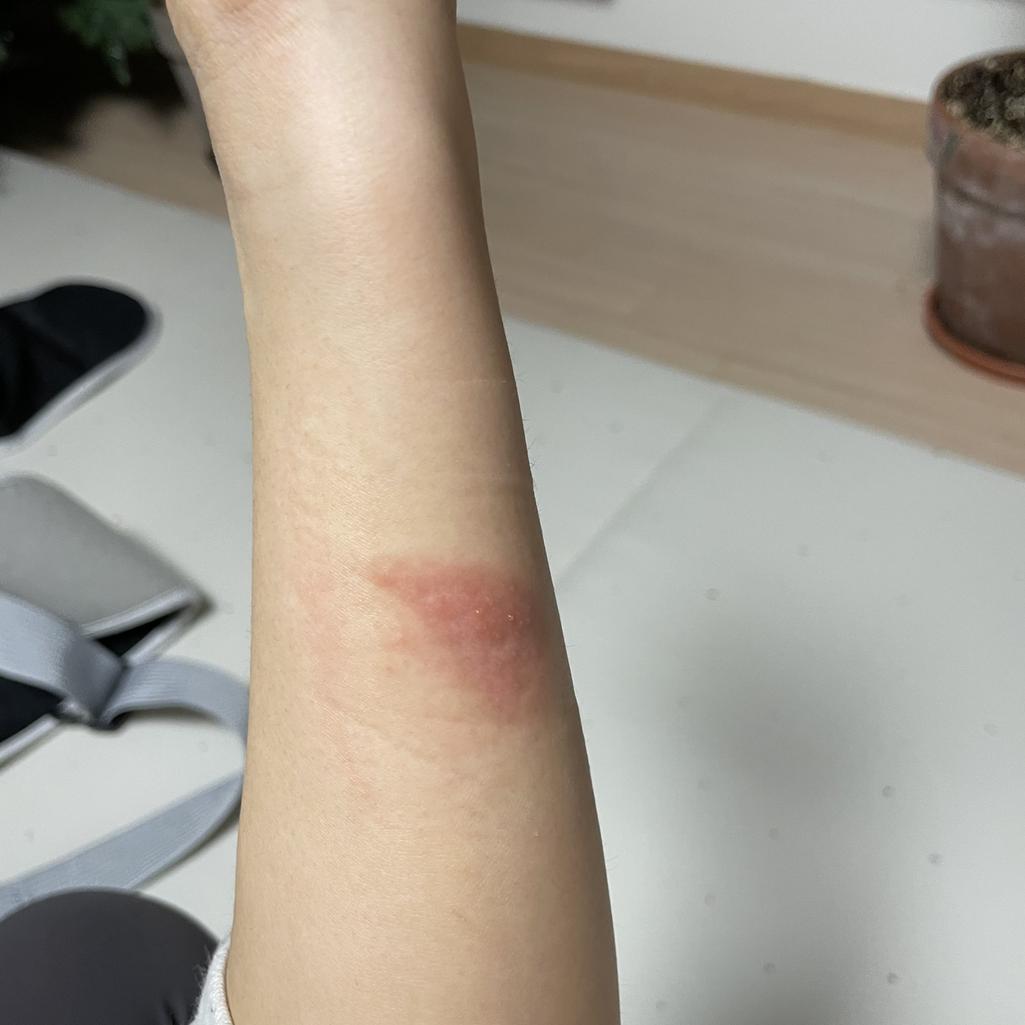 2번 째 사진