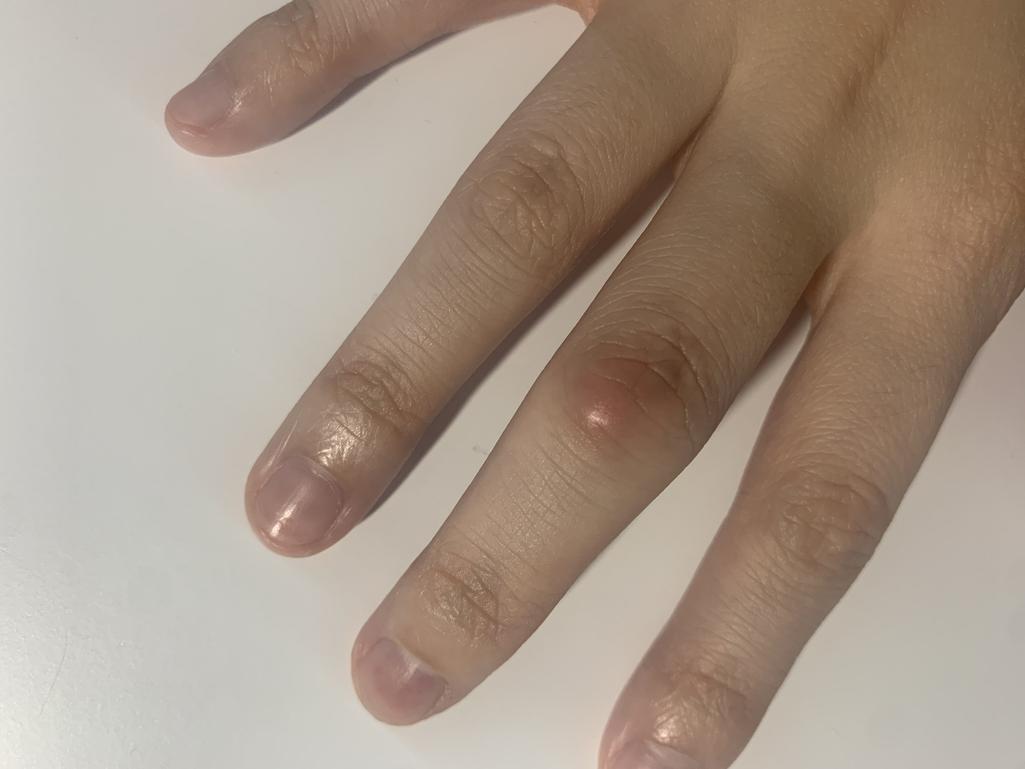 5번 째 사진