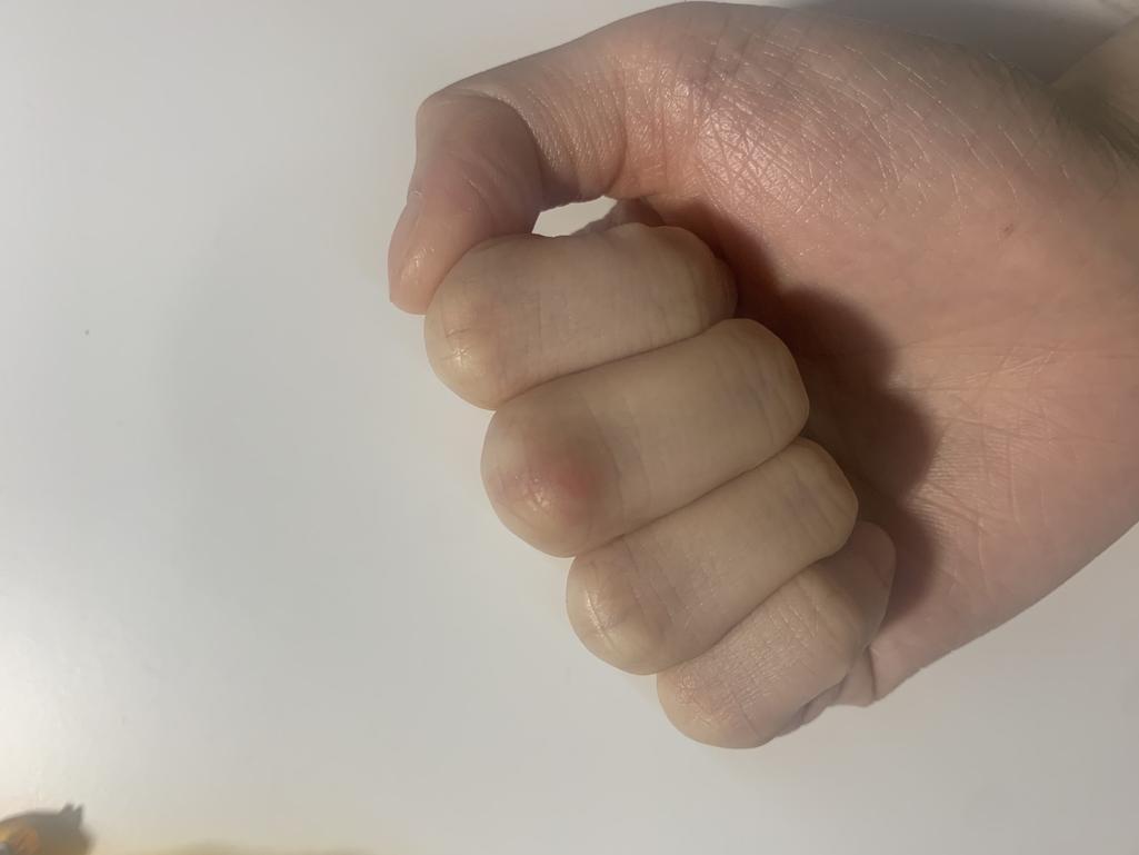 2번 째 사진