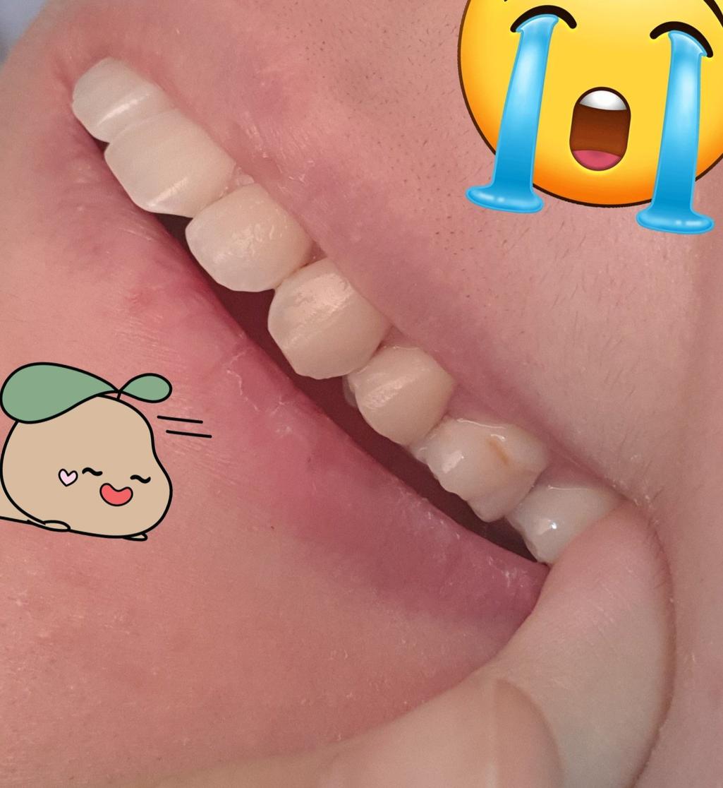 2번 째 사진