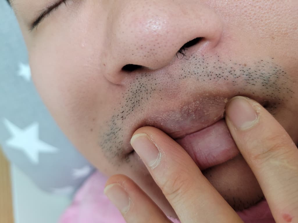 1번 째 사진