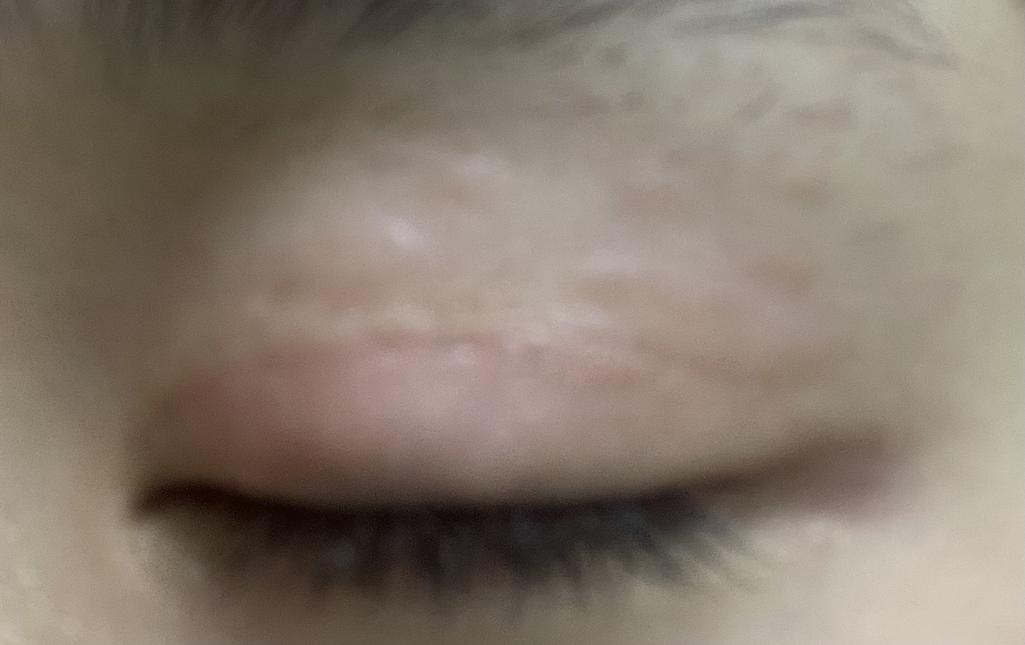 3번 째 사진
