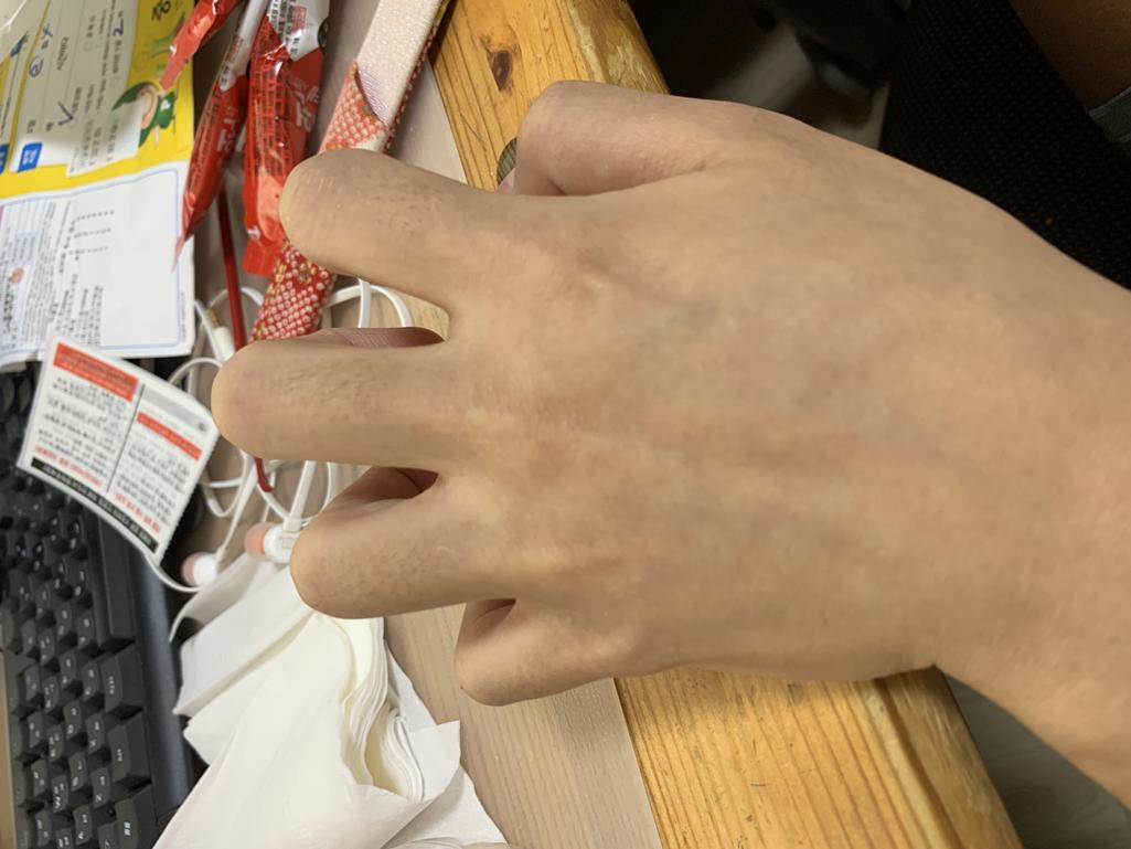 2번 째 사진