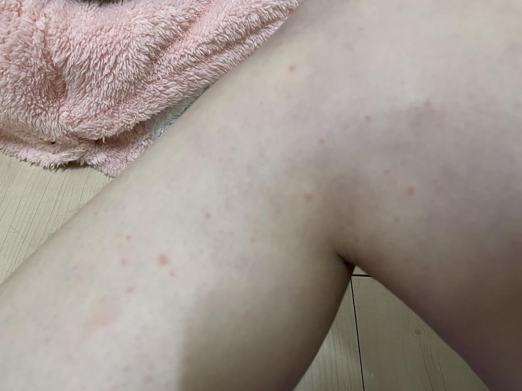 3번 째 사진
