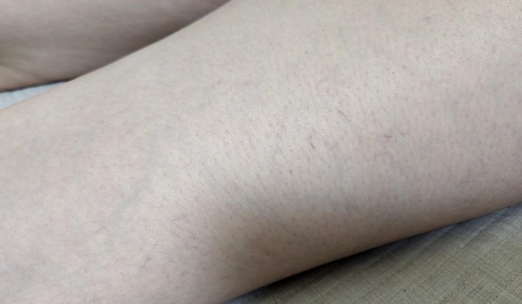 4번 째 사진