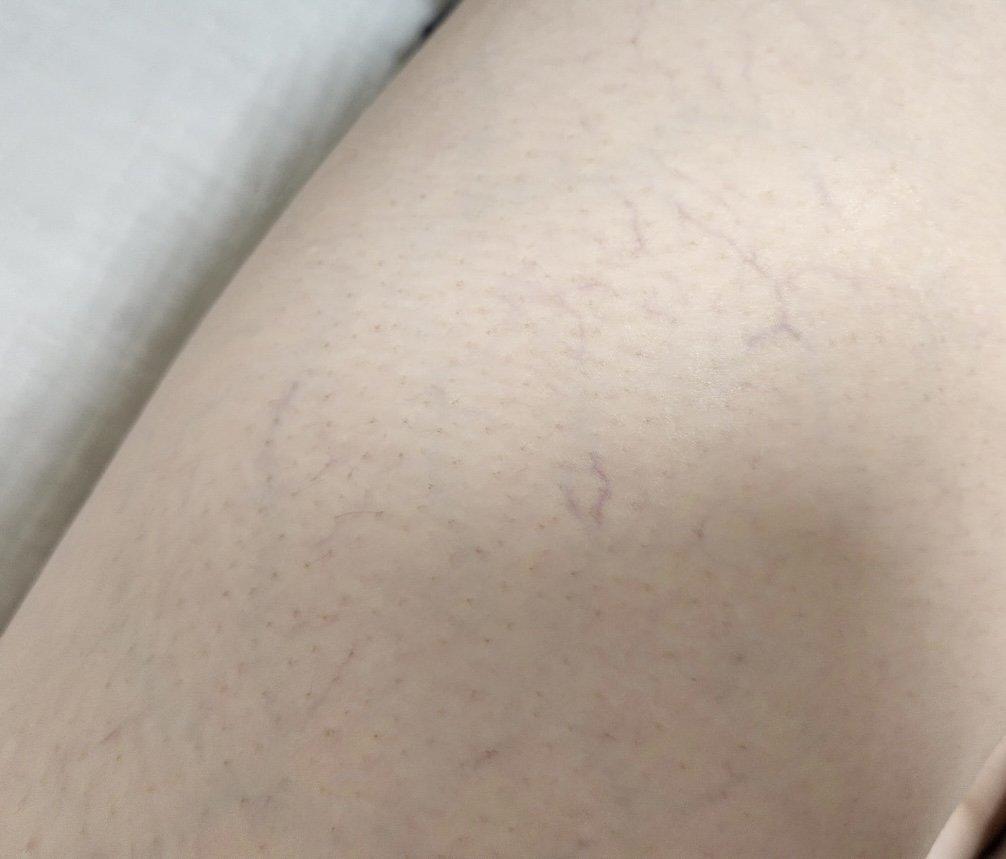 5번 째 사진