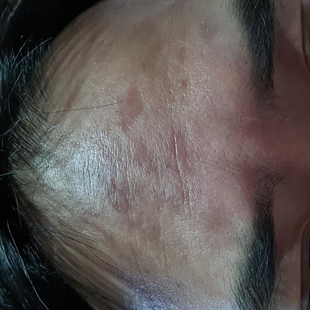 2번 째 사진