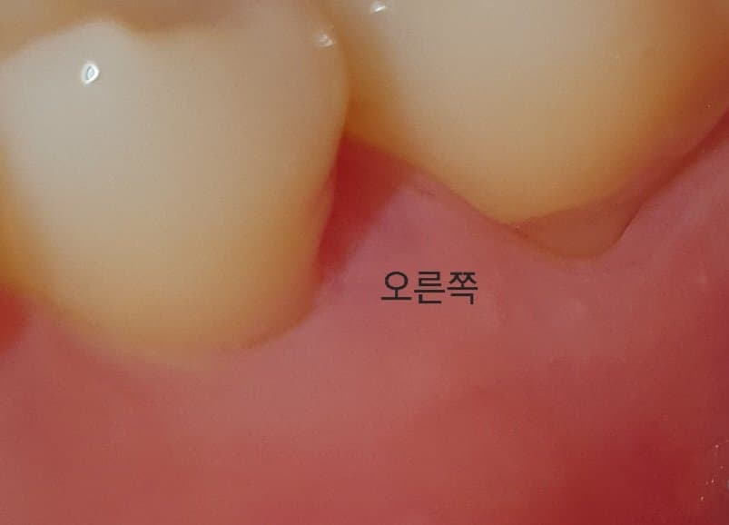 2번 째 사진