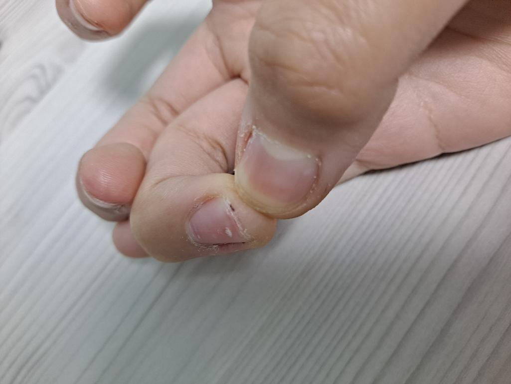 1번 째 사진
