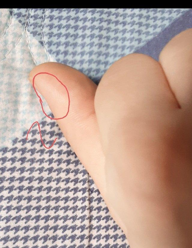 2번 째 사진