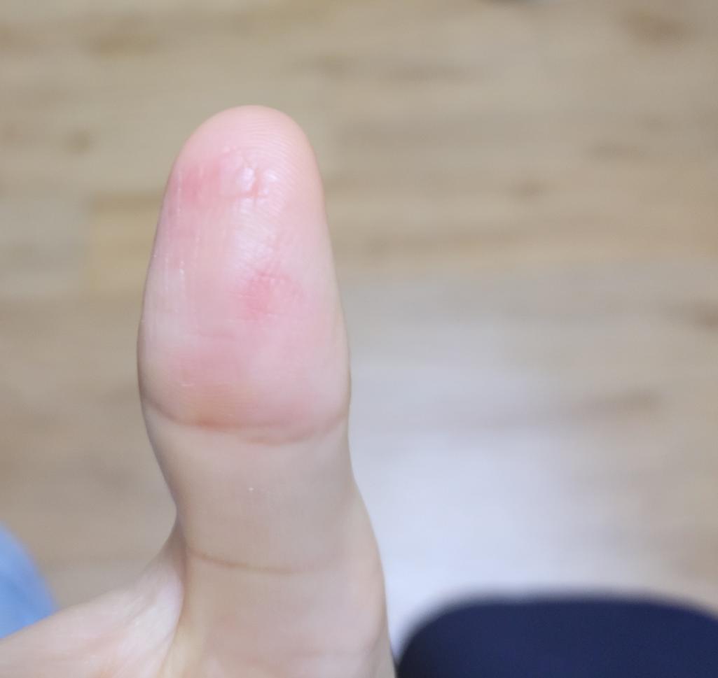 2번 째 사진