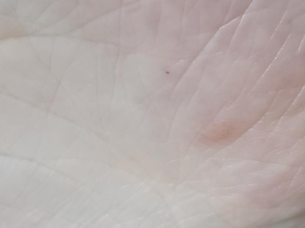 2번 째 사진