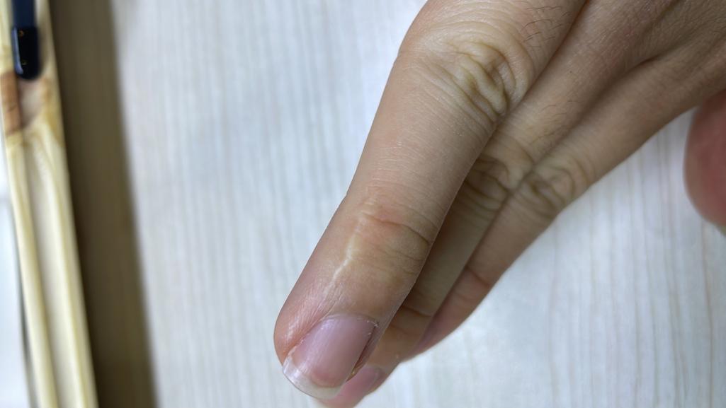 3번 째 사진