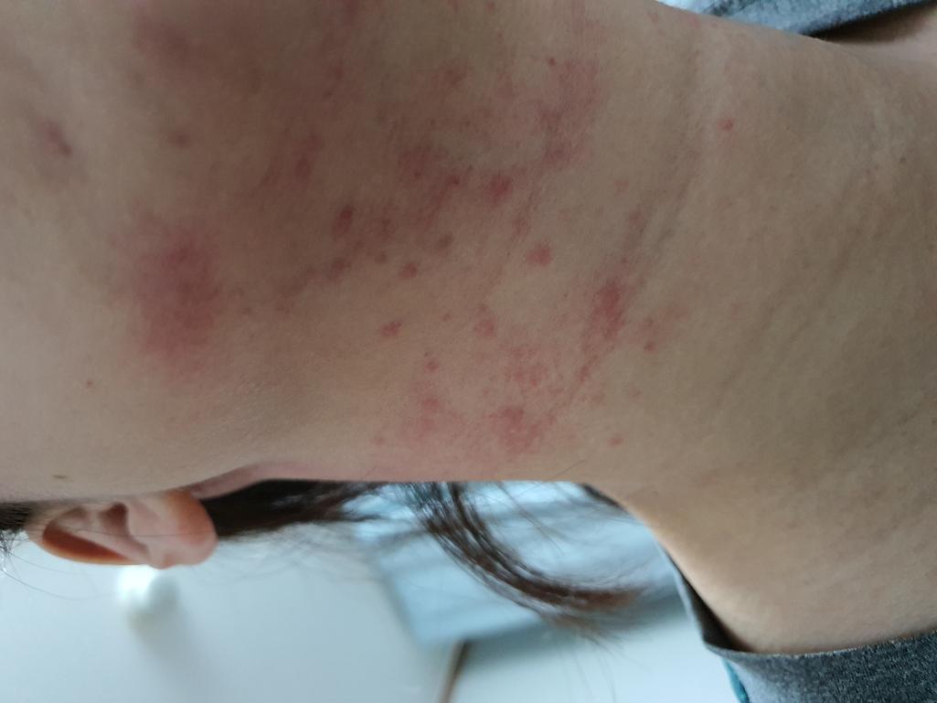 3번 째 사진