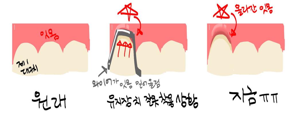 1번 째 사진