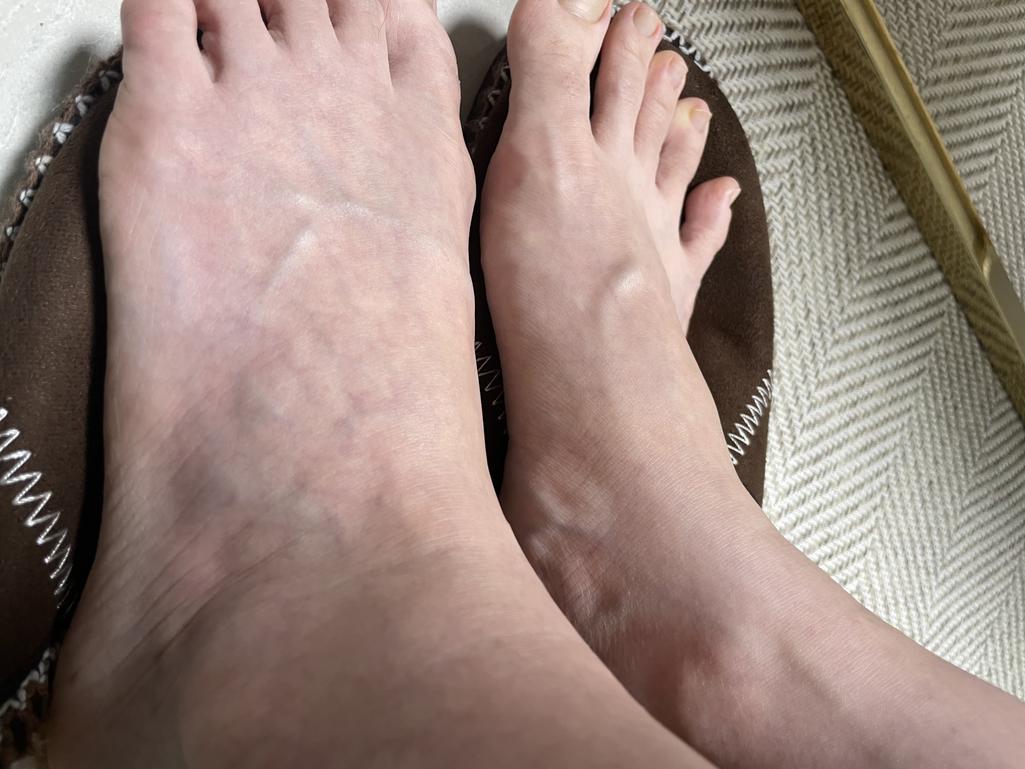 2번 째 사진