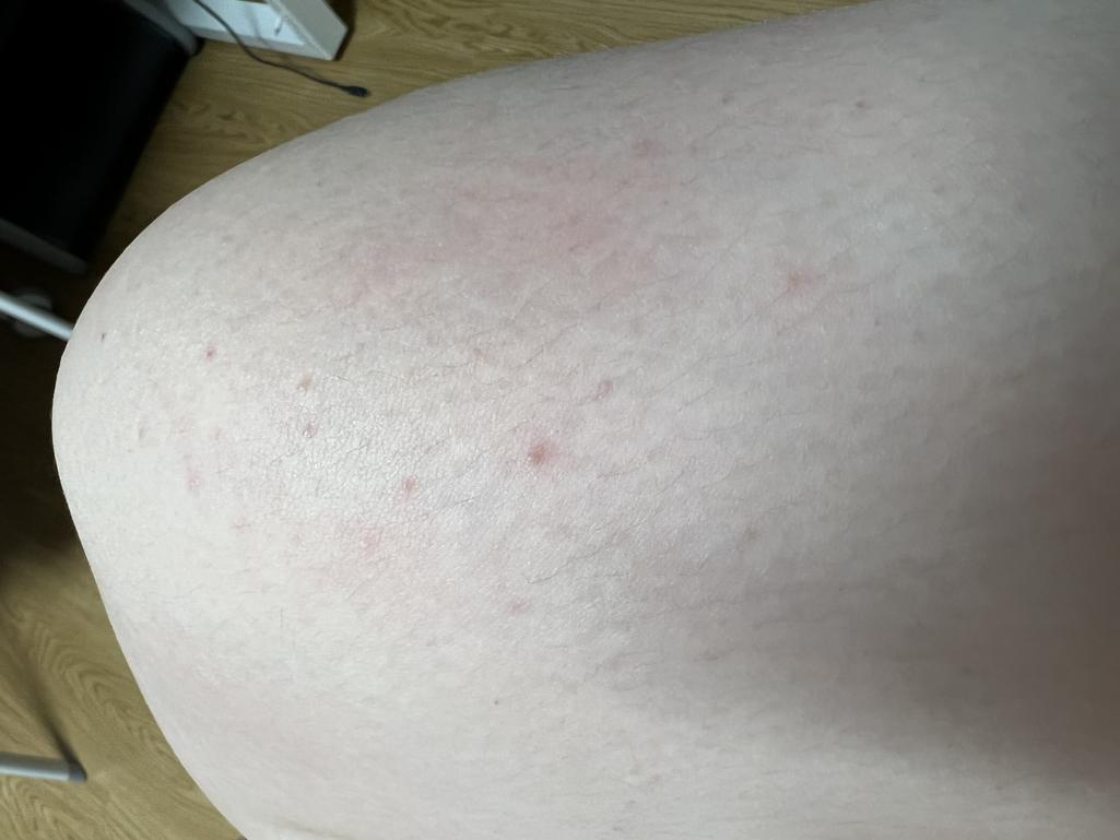 2번 째 사진