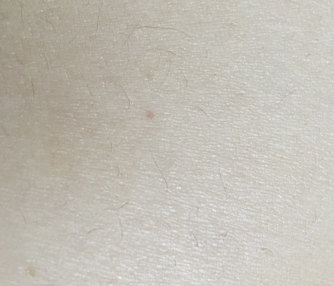 2번 째 사진