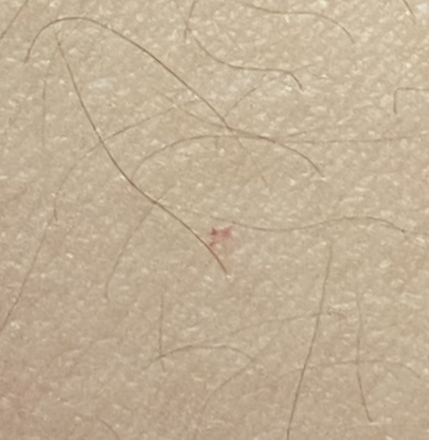 5번 째 사진