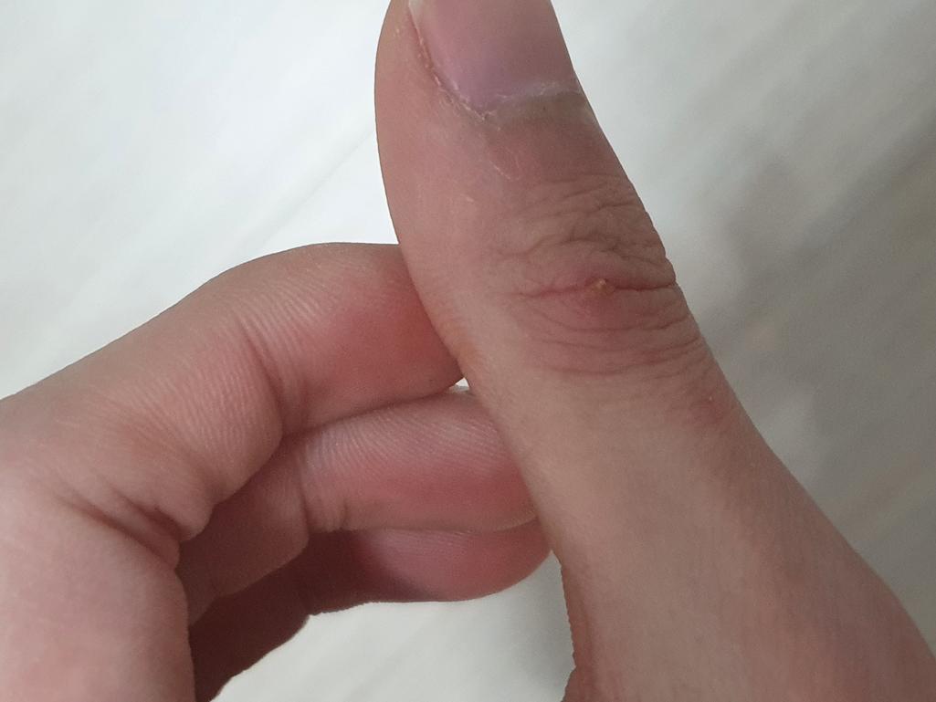 2번 째 사진