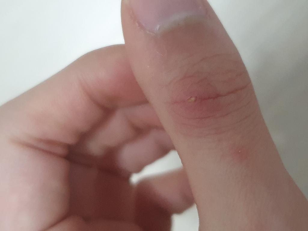 3번 째 사진
