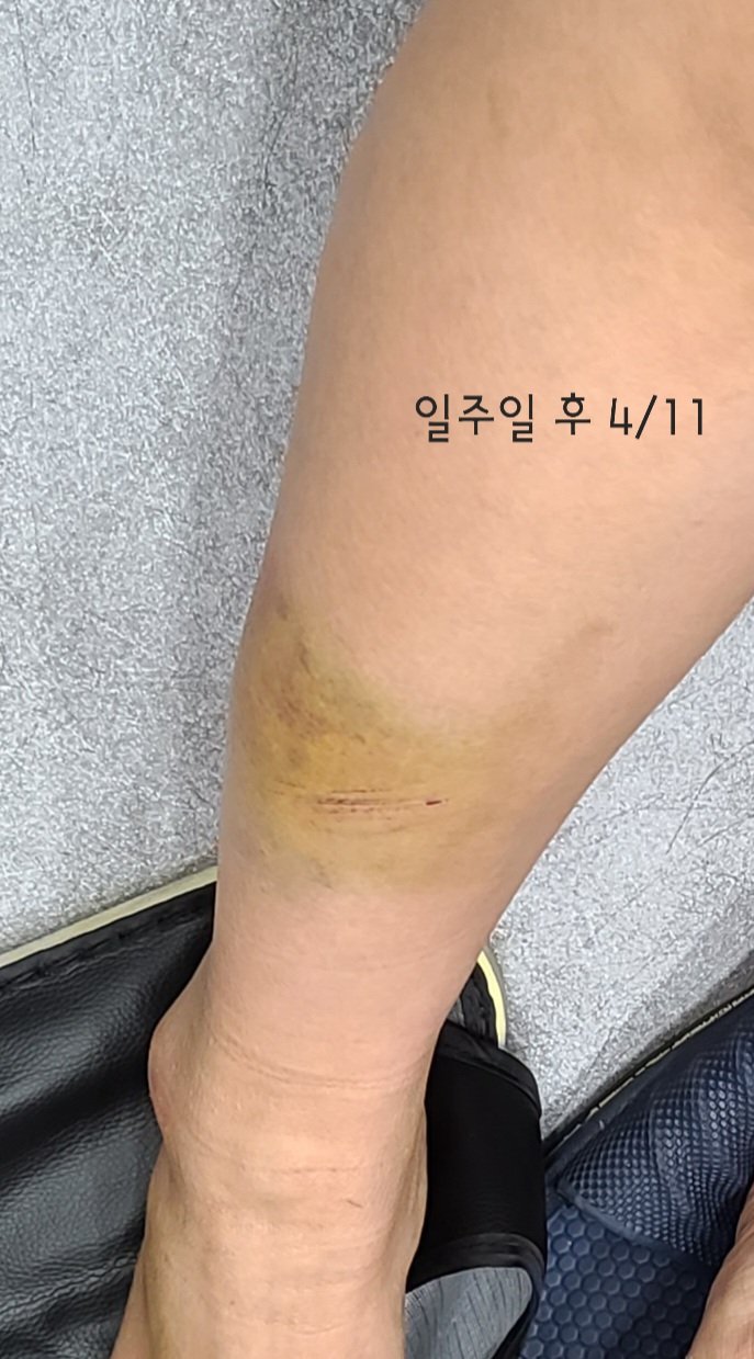 2번 째 사진