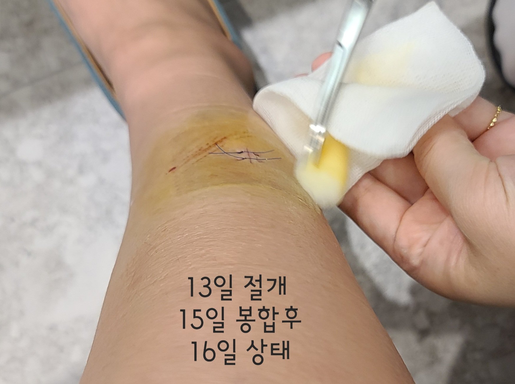 3번 째 사진