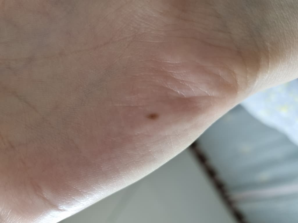 2번 째 사진