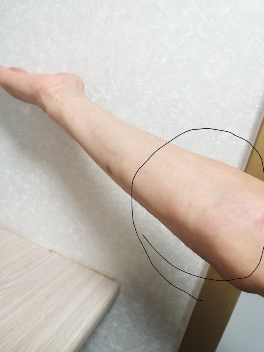 2번 째 사진