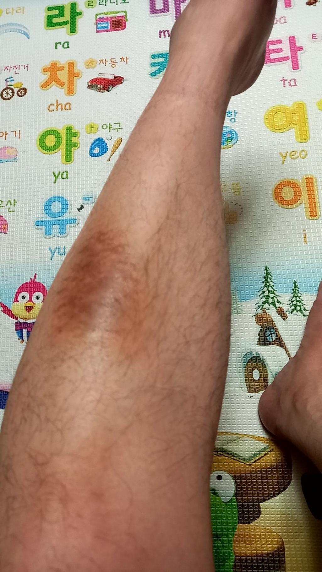 1번 째 사진