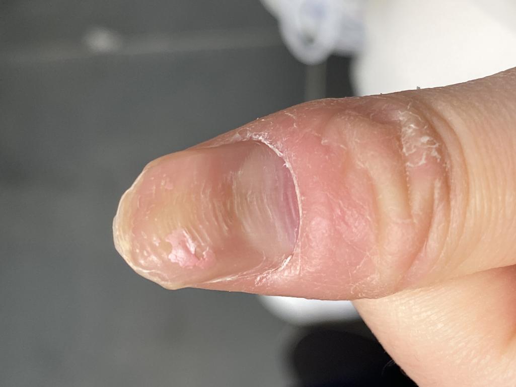 2번 째 사진
